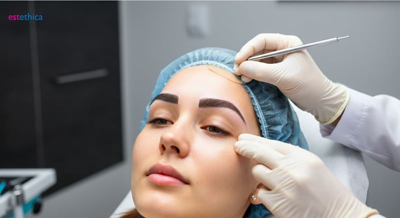 Candidatos para trasplante de cejas