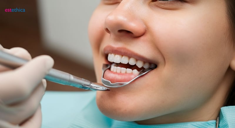 Estética dental avanzada: más allá del blanqueamiento dental