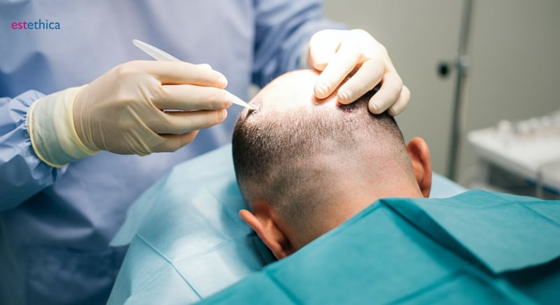 Advanced hair restoration techniques exploration