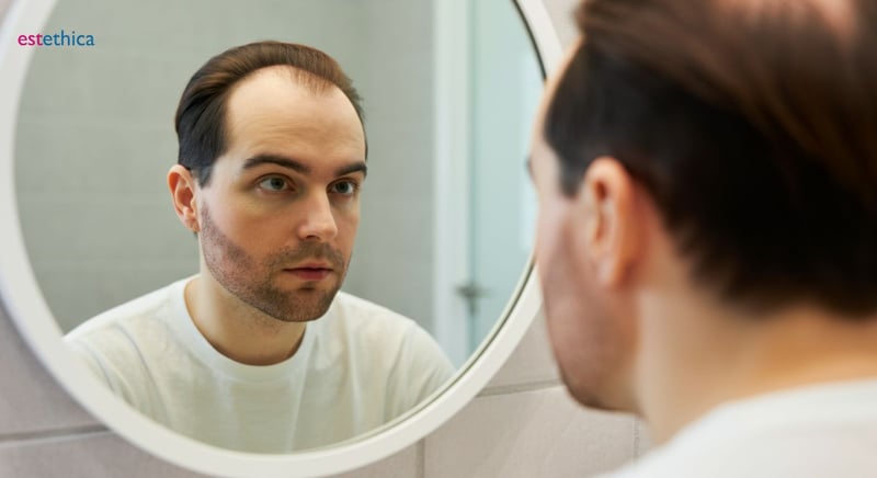 Exploring hair restoration techniques: FUE and more