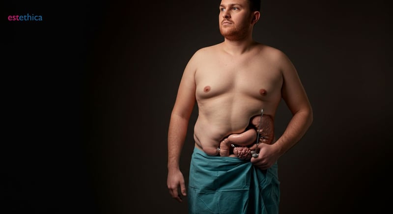 Exploring top bariatric surgery options