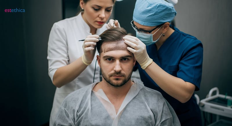 اختيار العيادة المثالية لزراعة الشعر