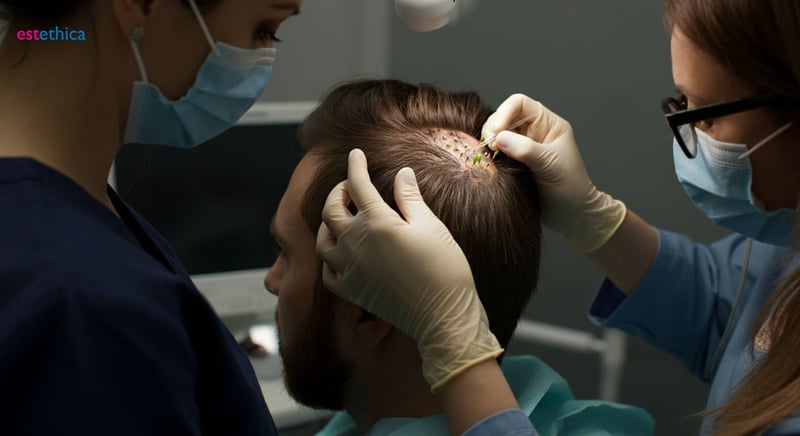 FUE vs. FUT hair transplant techniques comparison