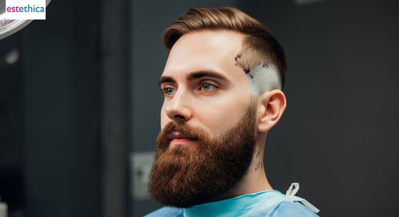 Step-by-step guide on beard transplants