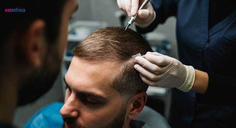 Modern Hair Restoration Techniques Beyond the Scalpel