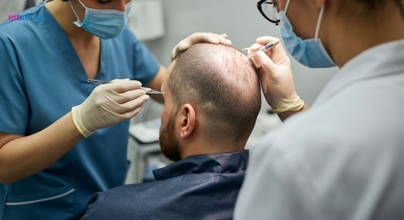 Multi DHI: Enhancing hair density and naturalness in implantation