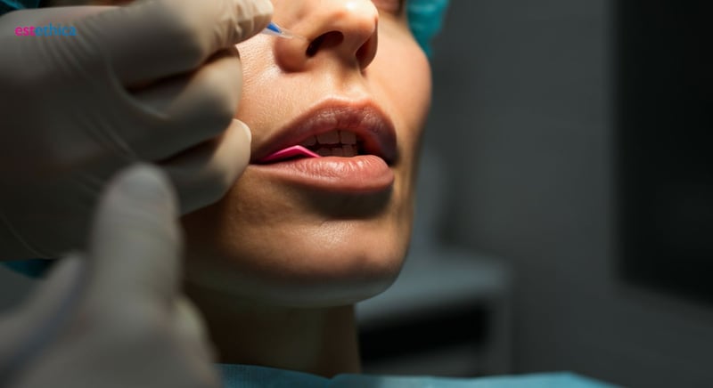 Oberlippenlifting Techniken: Welche passt zu Ihnen?
