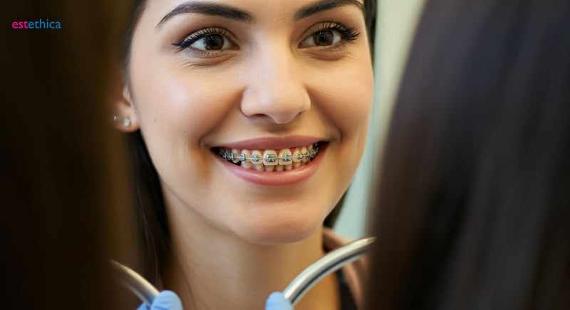 Ortodoncia para niños y adolescentes: Sonrisa saludable a tiempo