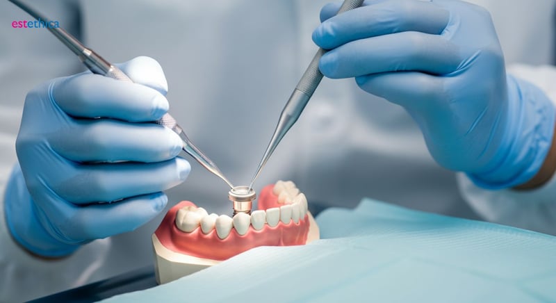 Osseointegration process of dental implants with jawbone