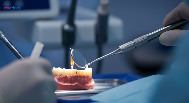 Osseointegration in dental implants