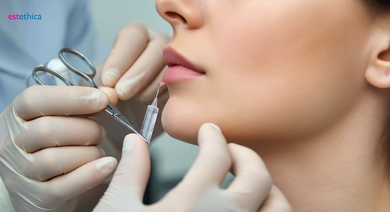 Philtrum Verkürzung für volle Lippen