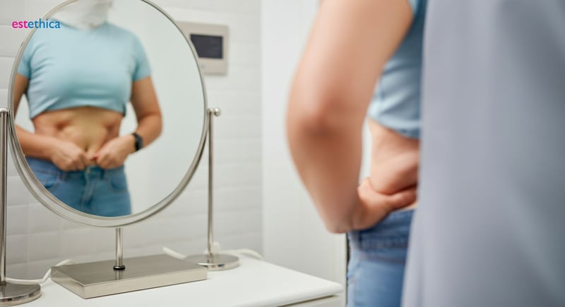 Plastie abdominale : préparation et convalescence