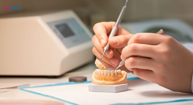 Porcelain veneers for smile enhancement