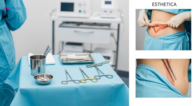 Post-pregnancy tummy tuck for pre-baby body confidence