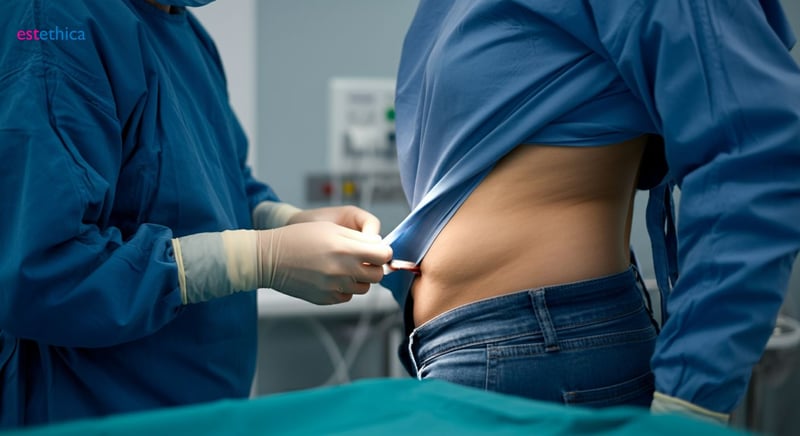 Pregătirea pentru chirurgia abdominală: Pași esențiali