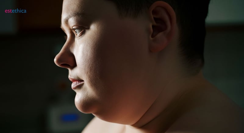 Preparing for Bariatric Surgery: Essential Steps