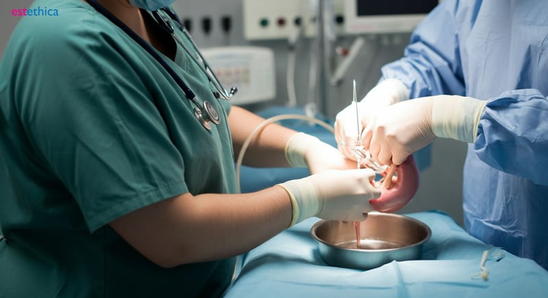 Pre-surgery weight loss tips for success