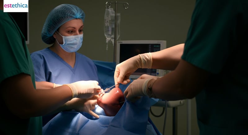 Preparing for Success: Steps Before Surgery