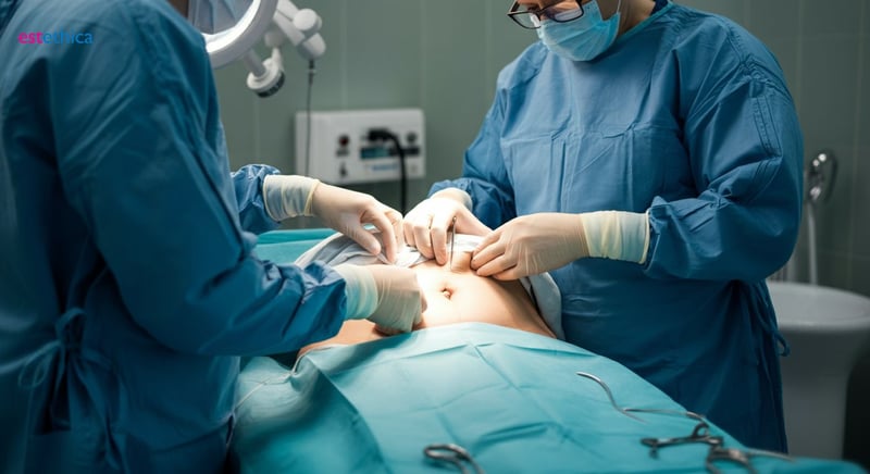 Recuperare eficientă după abdominoplastie: sfaturi esențiale