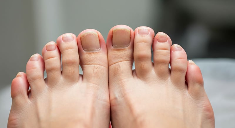 Remedios caseros vs. tratamientos dermatológicos: comparación de eficacia