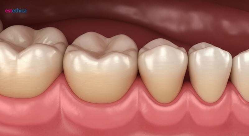 Retracția gingivală: impact asupra sănătății orale