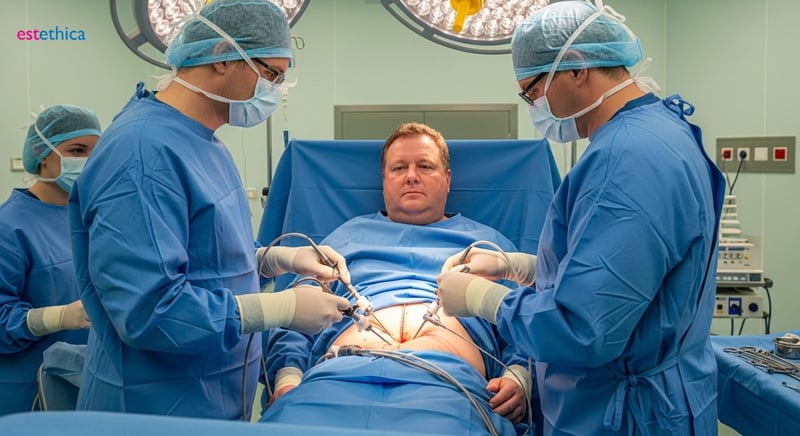 Schlauchmagen OP Methoden