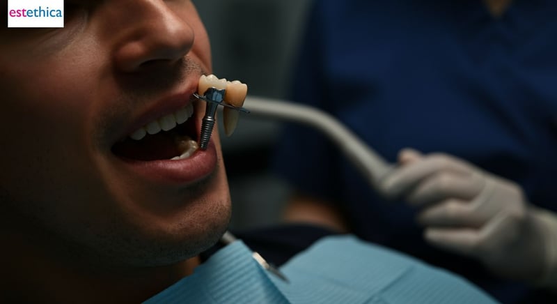 Schmerzen nach Zahnimplantat-OP: Was erwartet Sie?