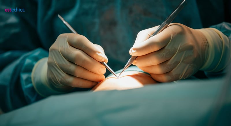 Schlüssel zu mehr Sichtbarkeit in der Plastischen Chirurgie