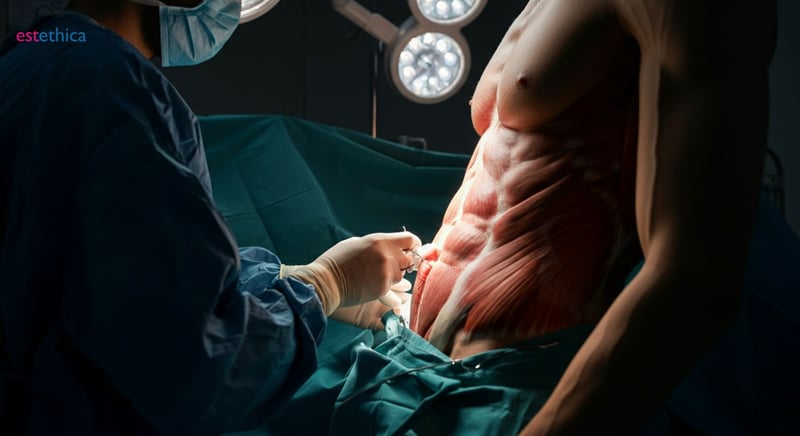 Post-operation recovery journey expectations