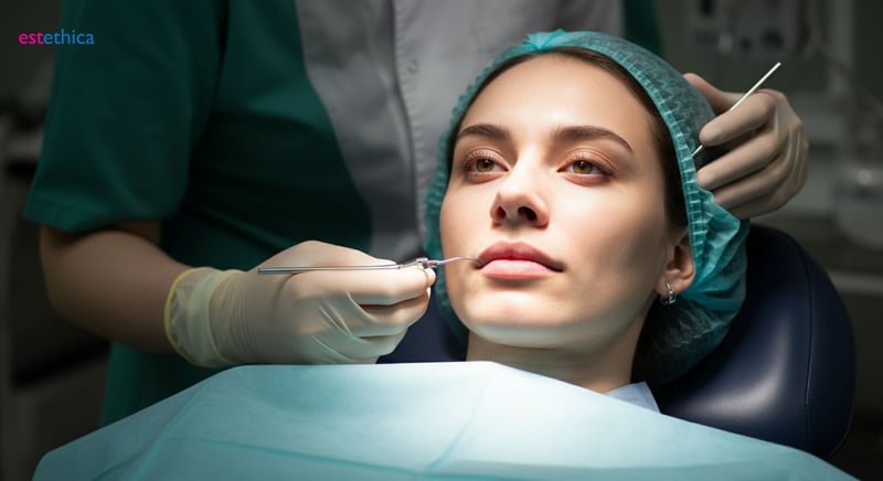 Tipos de levantamiento de labio superior: guía para elegir el ideal