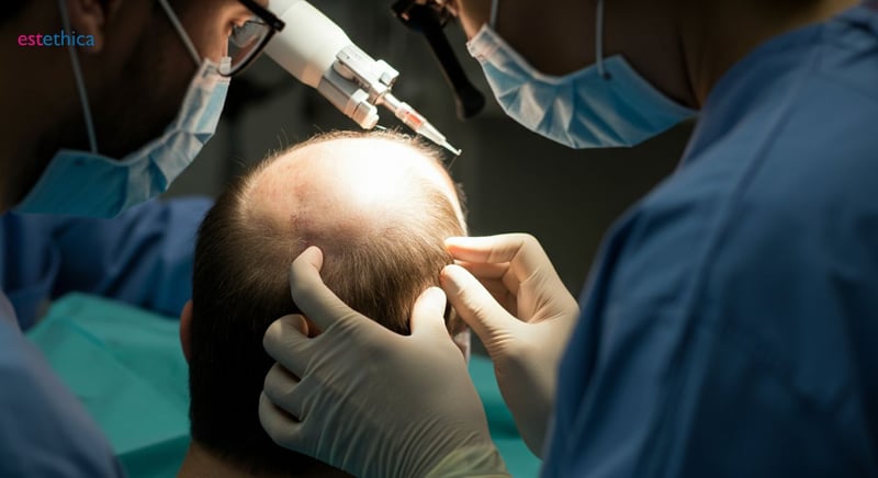 Top hair restoration techniques explained