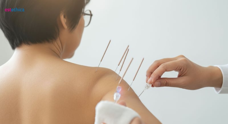 Tratamiento de acupuntura para equilibrio integral