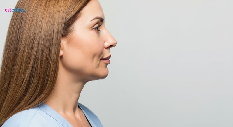 Tratamiento para papada: técnicas innovadoras y resultados sorprendentes