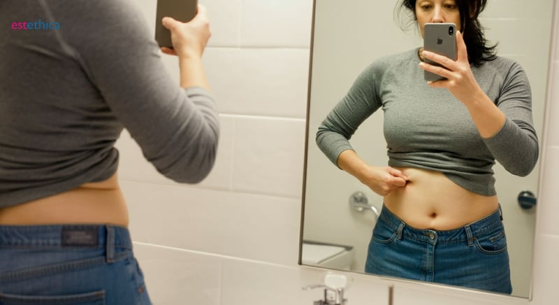 Tummy Tuck Recovery Time: Post-Surgery Expectations