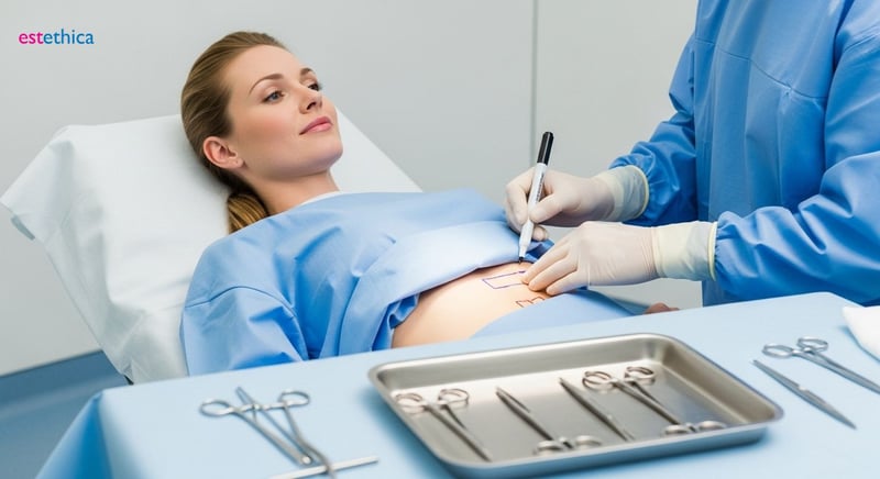 Tummy Tuck Surgery Results