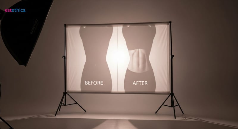 Understanding abdominoplasty: Is a tummy tuck right for you?