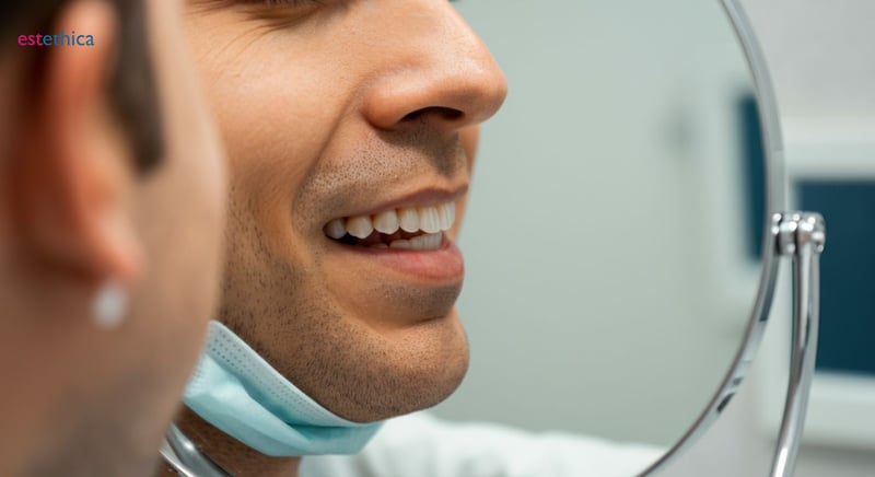 Veneers Vorher-Nachher: Beeindruckende Ergebnisse