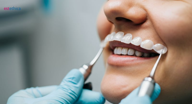 Vorteile der ästhetischen Zahnmedizin mit Veneers