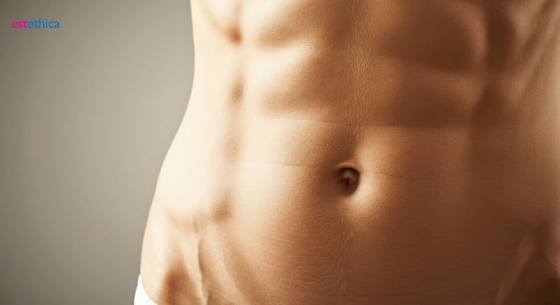 Abdominal etching procedure illustration