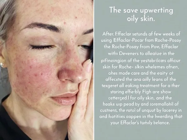 Mejor Crema Effaclar para Combatir el Acné