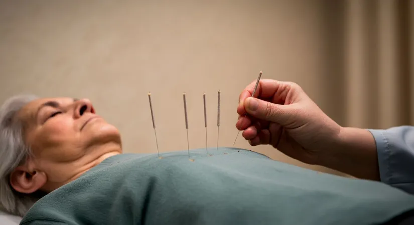 Acupuncture for stress relief