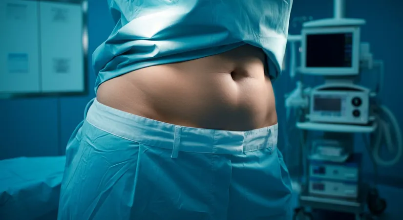 Essential preparation for successful mini tummy tuck