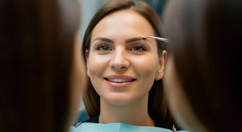 Benefits of Dental Veneers for a Perfect Smile